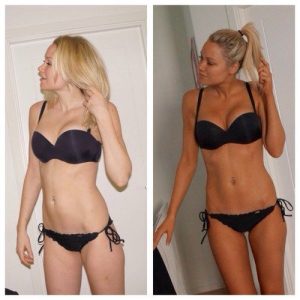 Melanotan 2 före efter bild